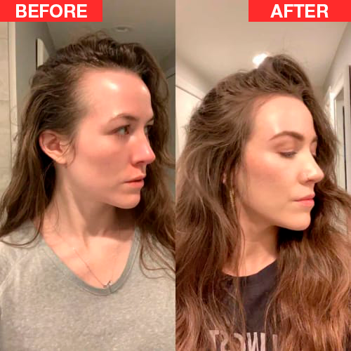 Scalp Glow max