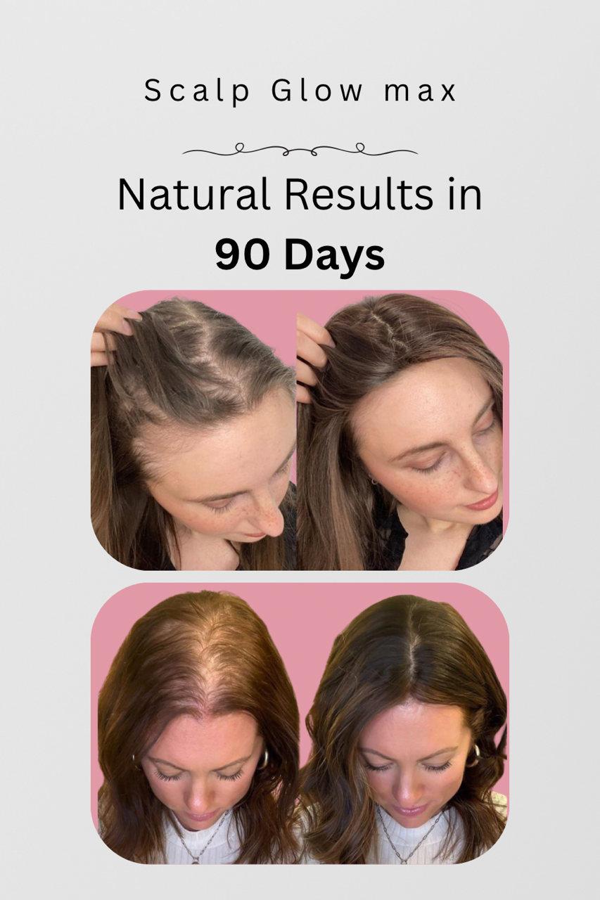 Scalp Glow max